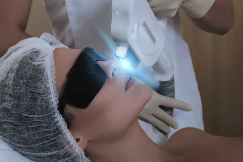 The woman is wearing sunglasses to undergo the laser treatment procedure.