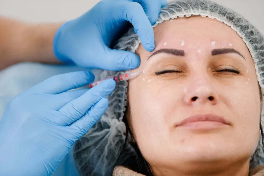 An adult woman is receiving a Botox injection from a doctor wearing blue gloves.