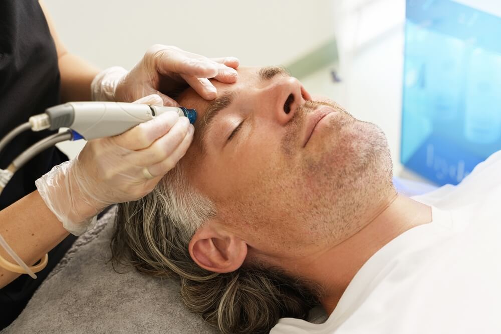 man under the microdermabrasion process