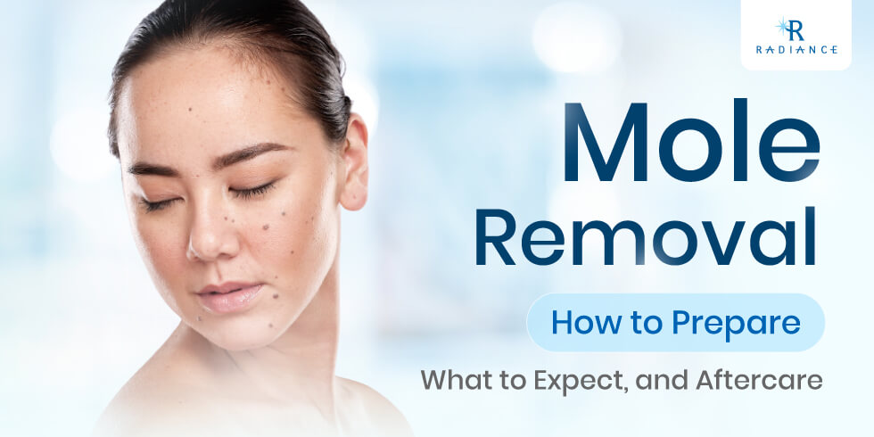 Mole Removal: How to Prepare, What to Expect, and Aftercare