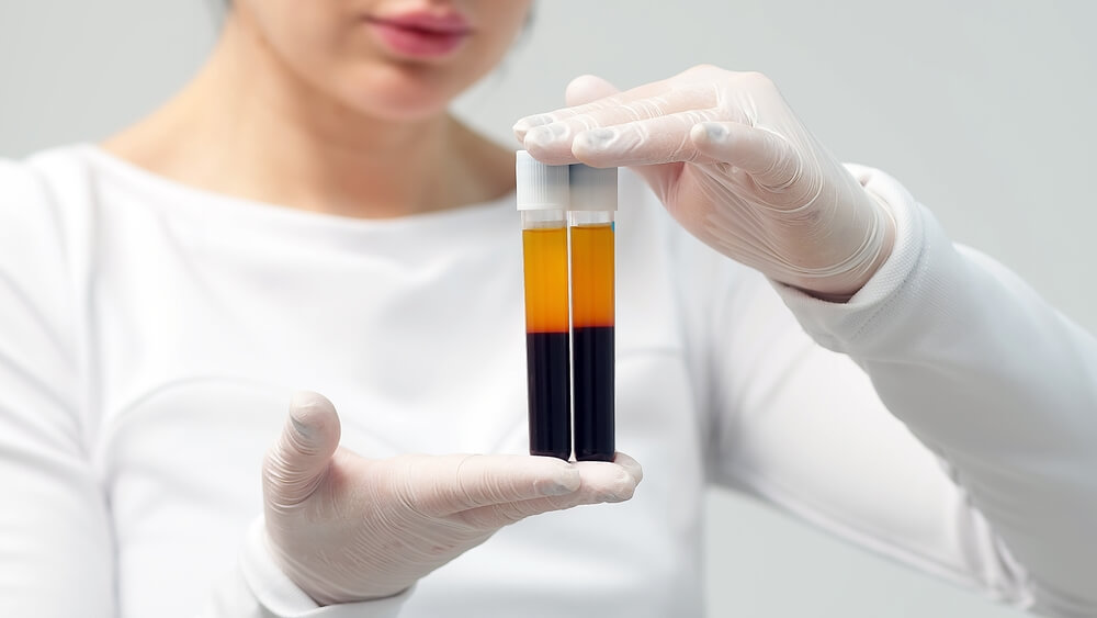 Tubes of separated PRP and red blood cells