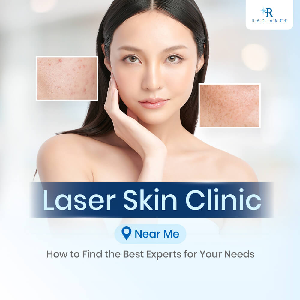 Laser Skin clinic near me