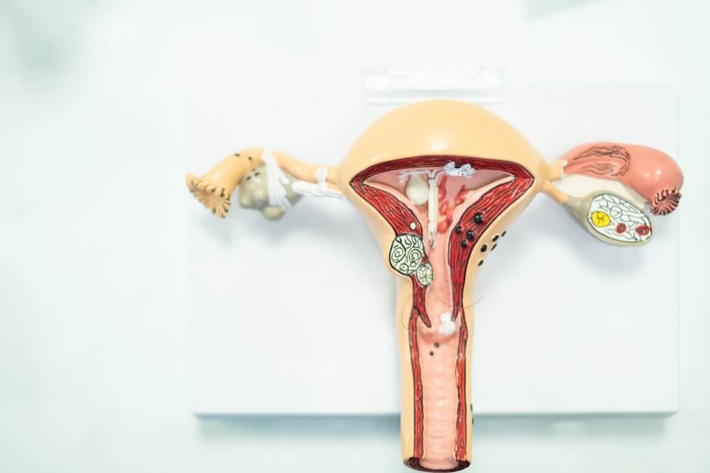 A model of women’s reproductive organs