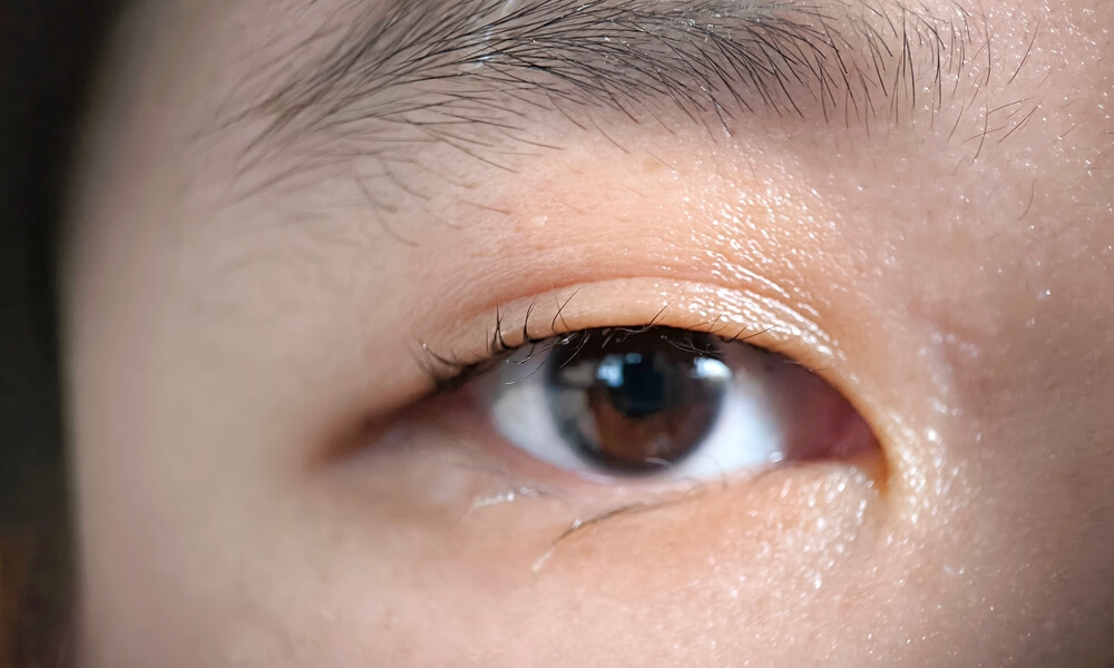 Close-up of an Asian woman with a monolid
