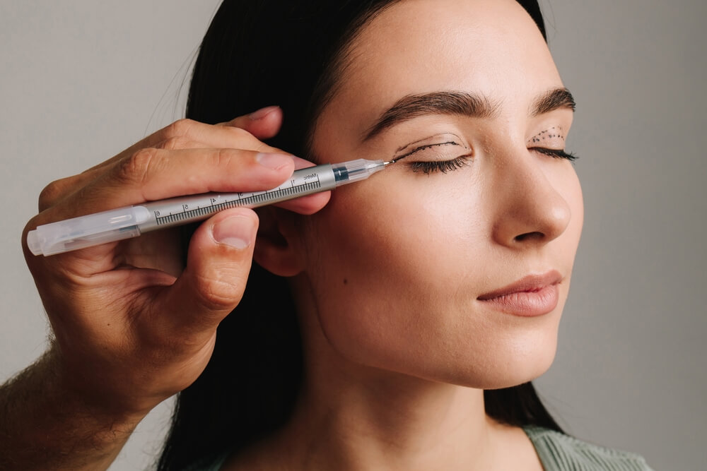 Patient under a planning process for blepharoplasty